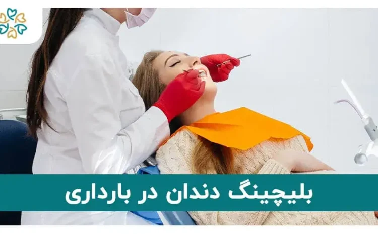  بلیچینگ دندان در حاملگی؛ آیا سفید کردن دندان برای زنان باردار ضرر دارد؟