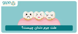 علت جرم دندان چیست؟
