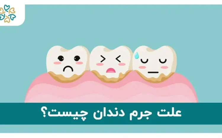  علت جرم دندان چیست؟