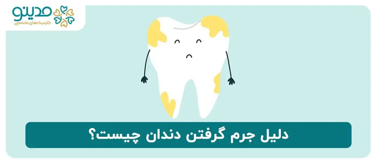 دلیل جرم گرفتن دندان چیست؟