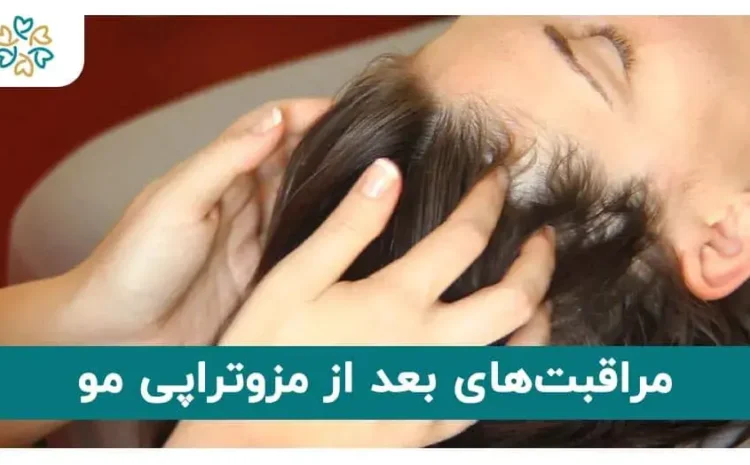  اقدامات بعد از مزوتراپی مو؛ بعد از مزو مو چه کنیم؟