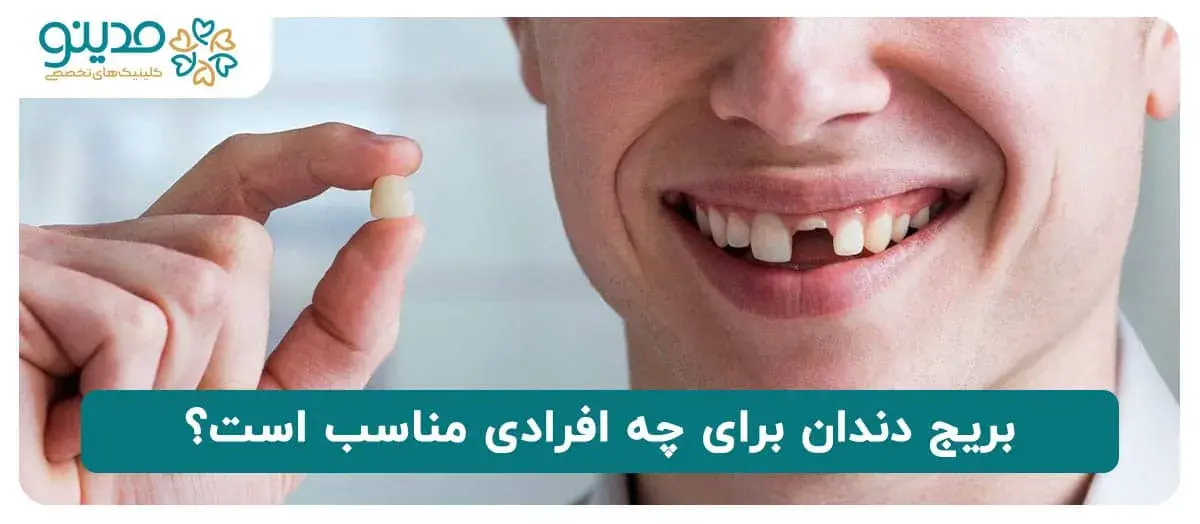 بریج دندان برای این افراد مناسب است!