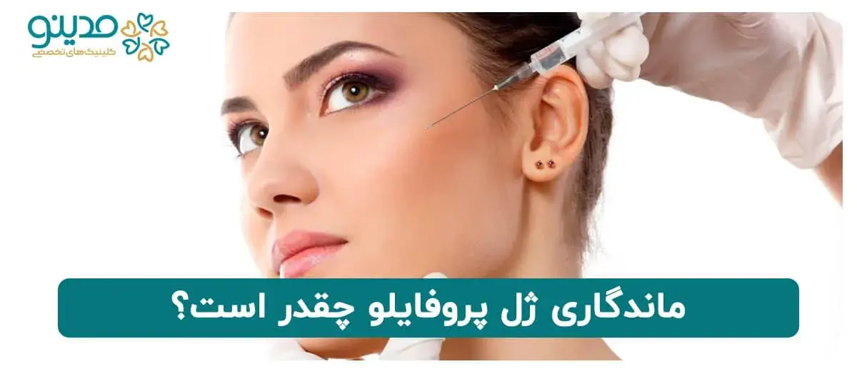 ماندگاری ژل پروفایلو چقدر است؟