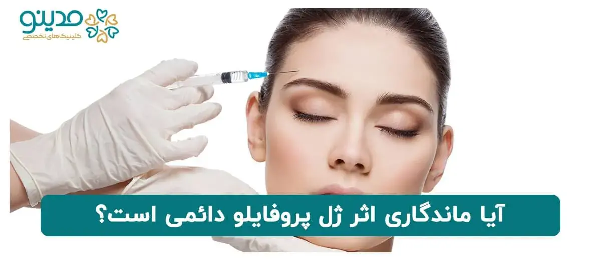 آیا ماندگاری اثر ژل پروفایلو دائمی است؟