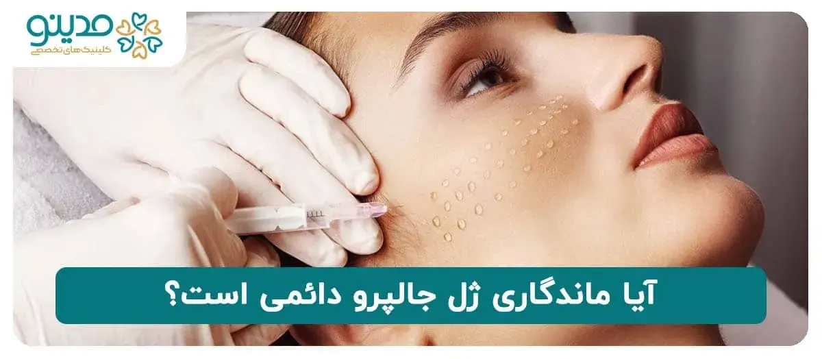 آیا ماندگاری ژل جالپرو دائمی است؟