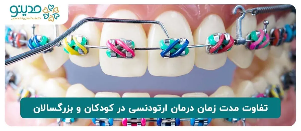 تفاوت مدت زمان درمان ارتودنسی در کودکان و بزرگسالان