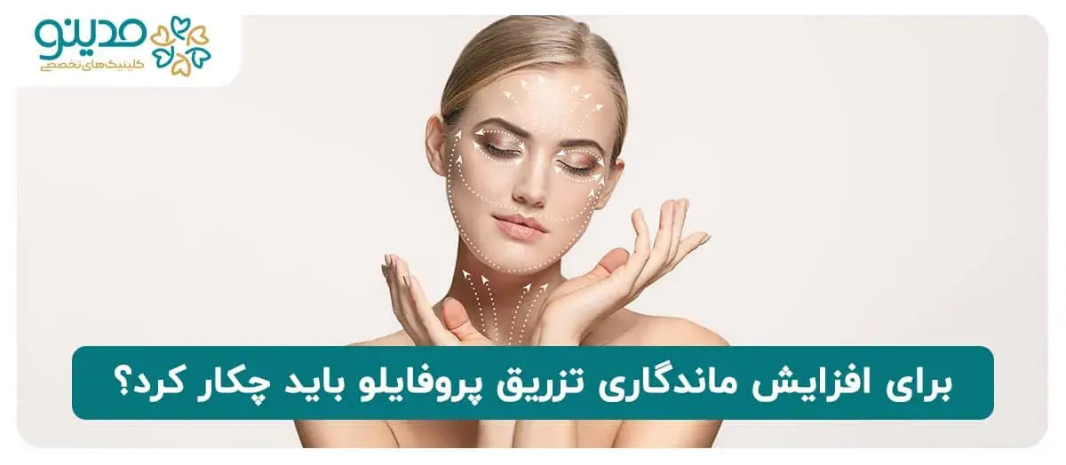 برای افزایش ماندگاری تزریق پروفایلو باید چکار کرد؟