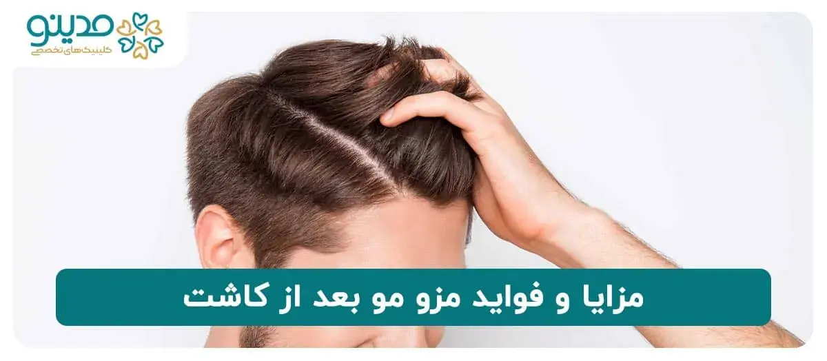 مزایا و فواید مزو مو بعد از کاشت