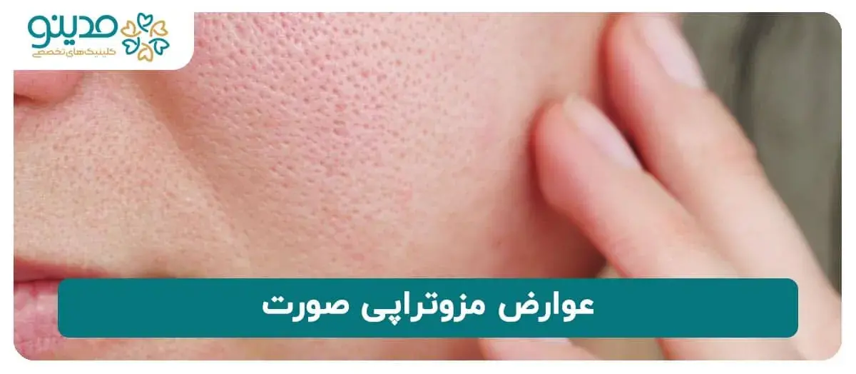 عوارض مزوتراپی صورت