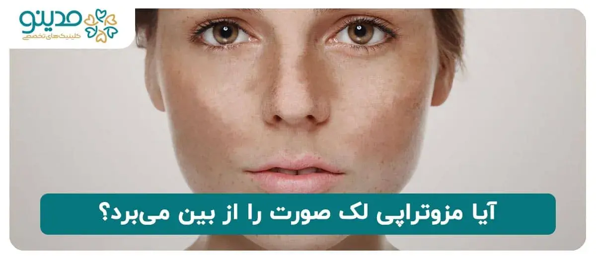 آیا مزوتراپی لک صورت را از بین می‌برد؟