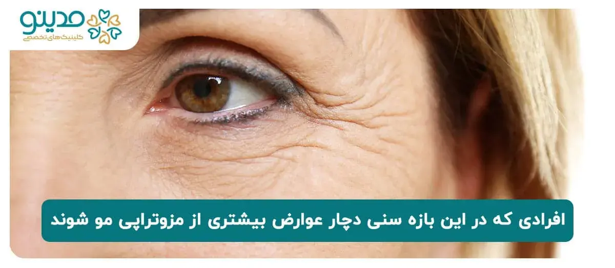 افراد در این بازه سنی ممکن است دچار عوارض بیشتری از مزوتراپی مو شوند