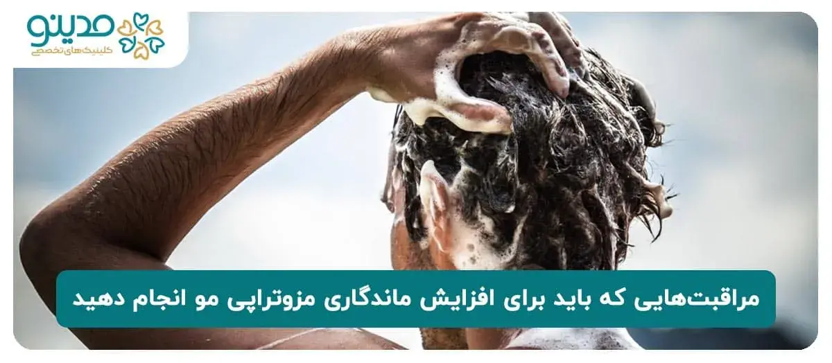 مراقبت‌هایی که باید برای افزایش ماندگاری مزوتراپی مو انجام دهید