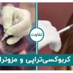 تفاوت کربوکسی‌تراپی و مزوتراپی مو