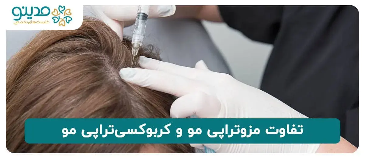 تفاوت مزوتراپی مو و کربوکسی‌تراپی مو