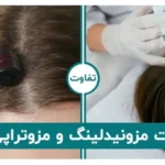 تفاوت مزونیدلینگ و مزوتراپی مو