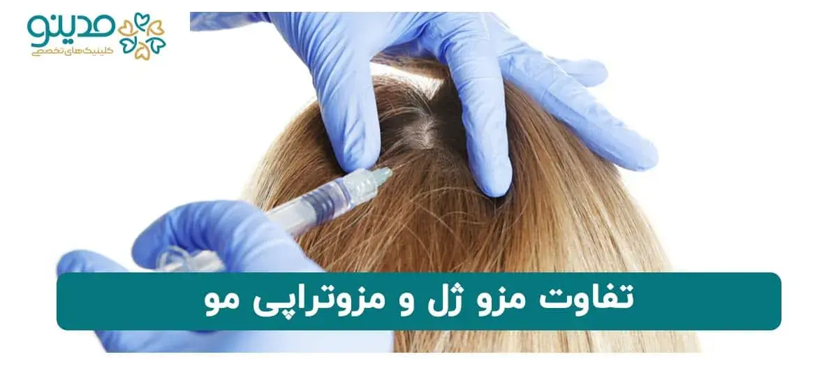 تفاوت مزوژل و مزوتراپی مو