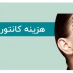 مطلب جامع در خصوص هزینه و تعرفه کانتورینگ صورت