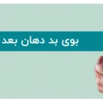 بوی بد دهان بعد از کامپوزیت