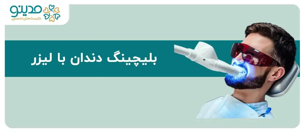 راهنمای جامع بلیچینگ دندان با لیزر