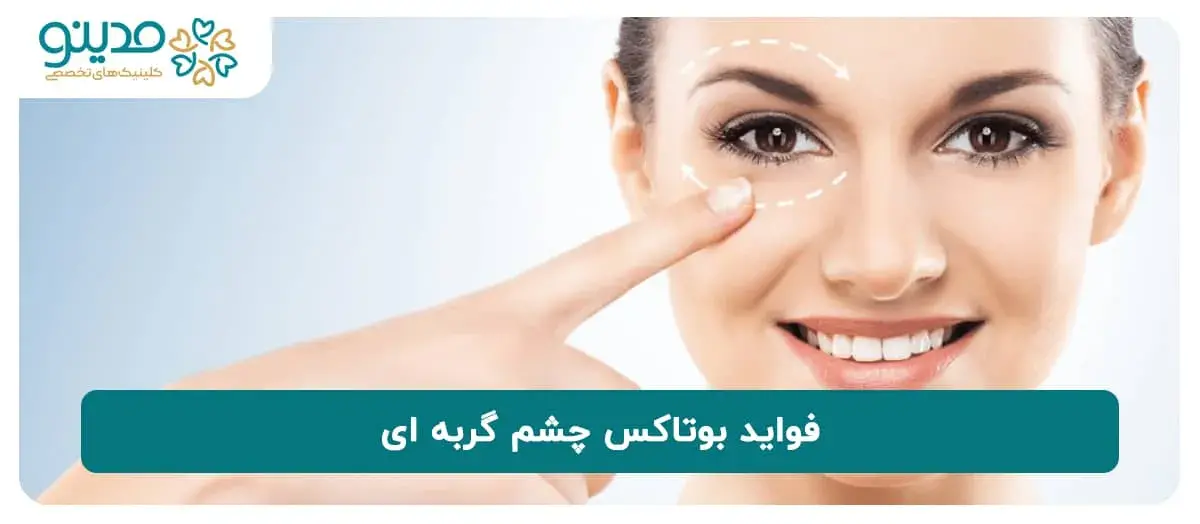 فواید و مزایای بوتاکس چشم گربه‌ای چیست؟