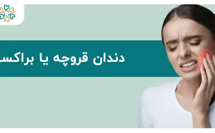  دندان قروچه یا براکسیسم؛ علل، علائم و روش‌های درمان مؤثر