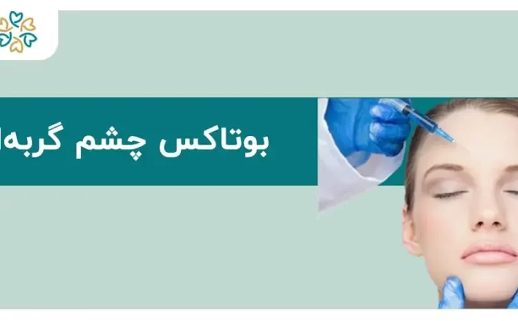  بوتاکس چشم گربه‌ای؛ لیفت بدون جراحی با ماندگاری بالا!