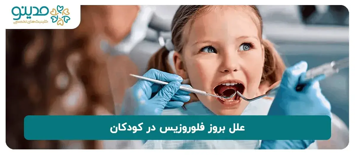 با علل بروز فلوروزیس در کودکان آشنا شوید!