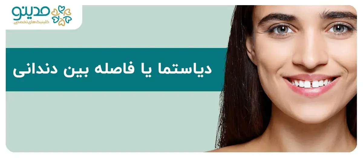 دیاستما یا فاصله بین دندانی چیست؟