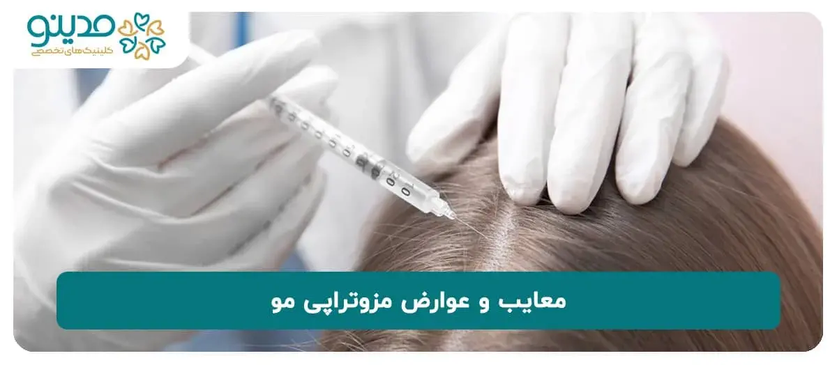 مزوتراپی مو چه معایب و عوارضی دارد؟