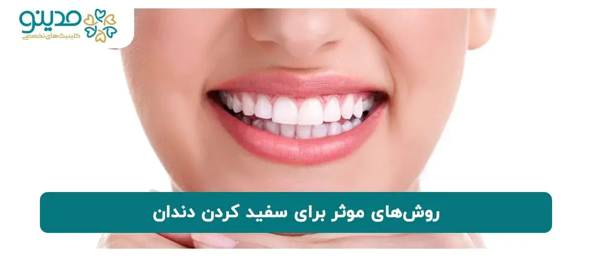 آشنایی با روش‌های موثر برای سفید کردن دندان