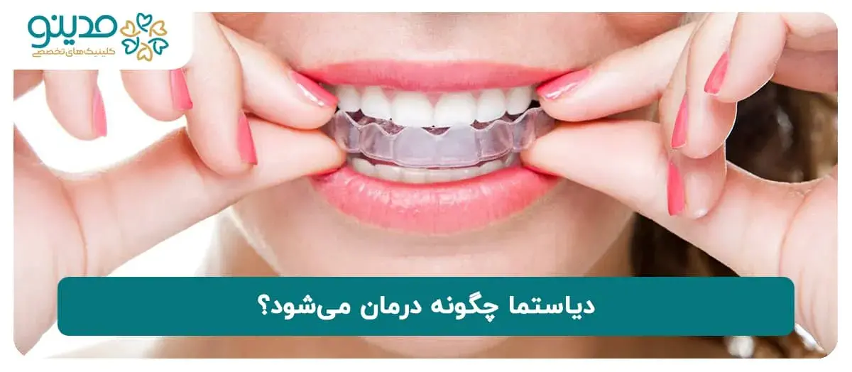 دیاستما چگونه درمان می‌شود؟