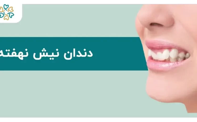  دندان نیش نهفته؛ علل، علائم و روش‌های درمان مؤثر