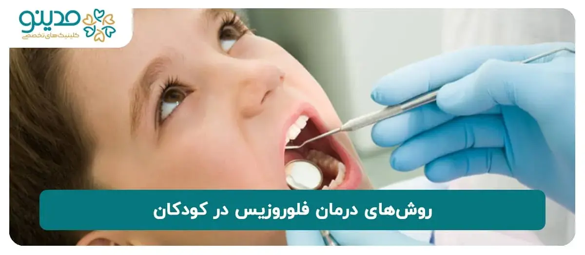 روش‌های درمان فلوروزیس در کودکان