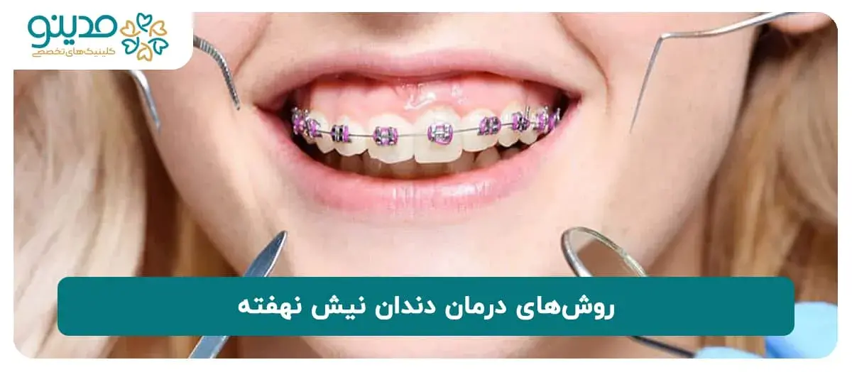 روش‌های درمان دندان نیش نهفته