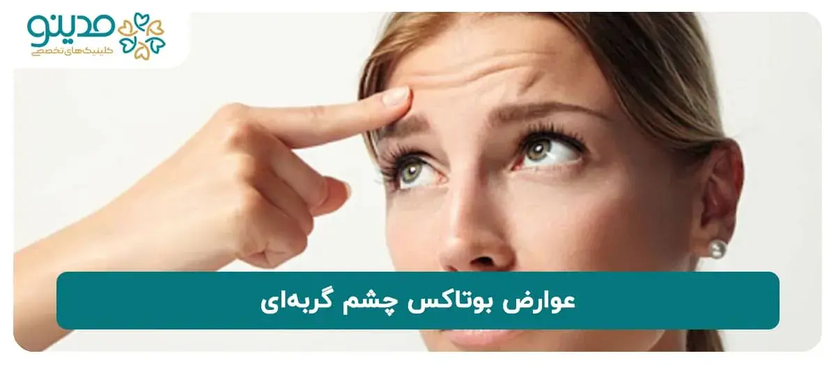 عوارض بوتاکس چشم گربه‌ای را بشناسید