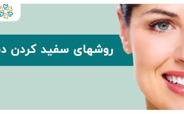  روشهای سفید کردن دندان؛ ۷ راهکار فوری برای لبخندی سفیدتر