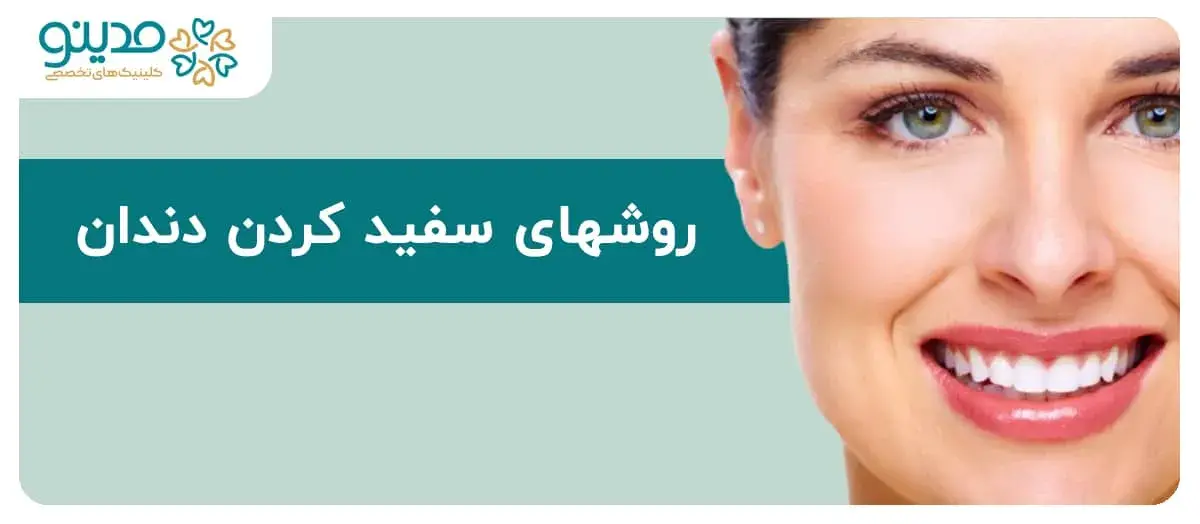راهنمای جامع روشهای سفید کردن دندان