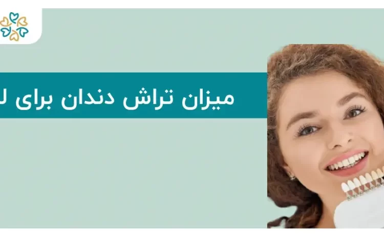  تراش دندان برای لمینت؛ نکات ضروری که باید بدانید