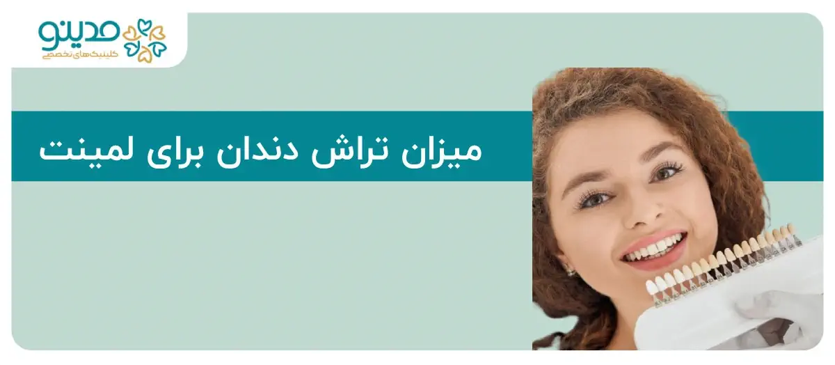 تراش دندان برای لمینت؛ نکات ضروری که باید بدانید