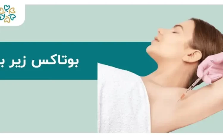  بوتاکس زیر بغل؛ راهکار مؤثر برای کنترل تعریق بیش از حد