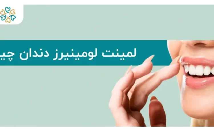  لمینت لومینیرز دندان؛ بدون تراش، بدون درد، لبخند طبیعی!