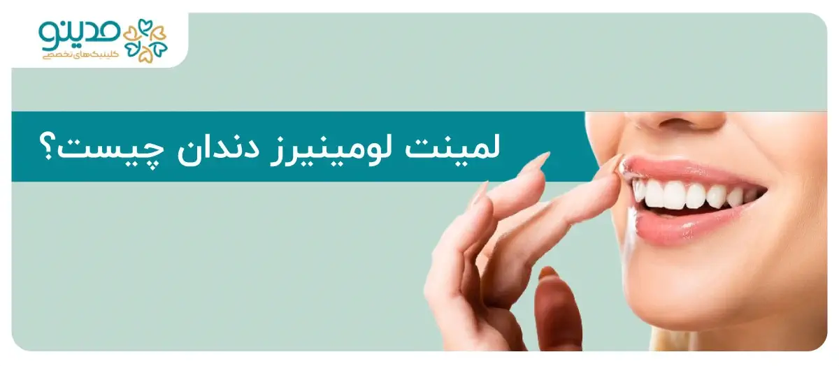 لمینت لومینیرز دندان؛ بدون تراش، بدون درد، لبخند طبیعی!