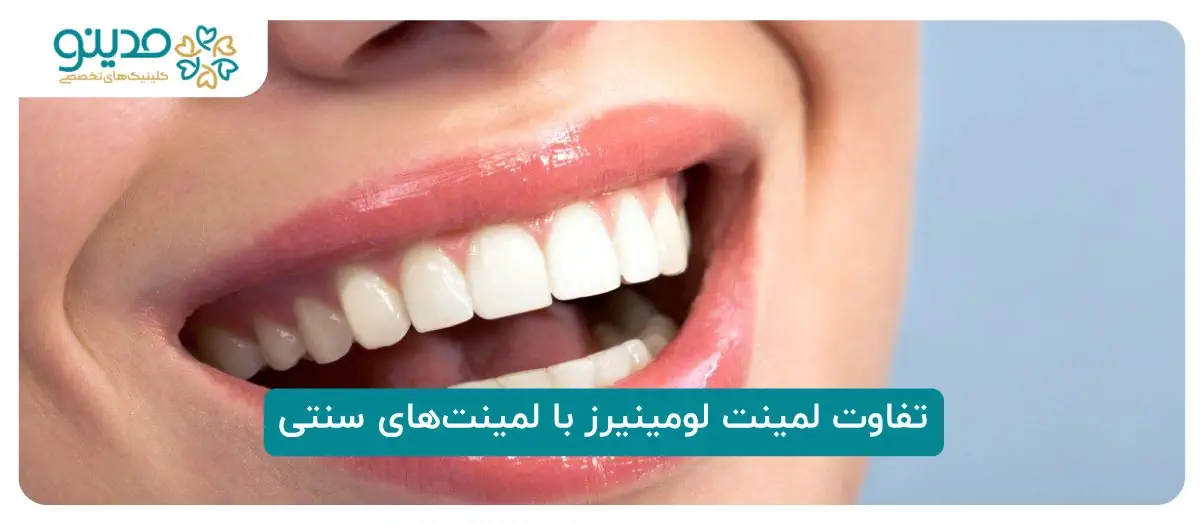 تفاوت لمینت لومینیرز با لمینت‌های سنتی