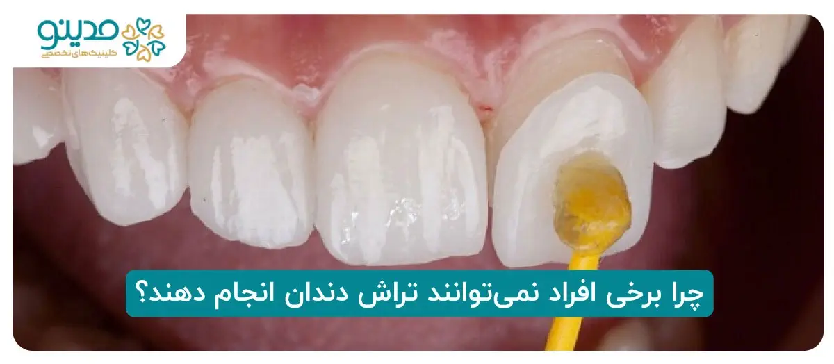 چرا برخی افراد نمی‌توانند تراش دندان انجام دهند؟