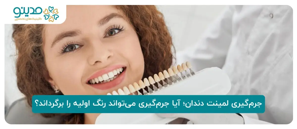 جرم‌گیری لمینت دندان؛ آیا جرم‌گیری می‌تواند رنگ اولیه را برگرداند؟