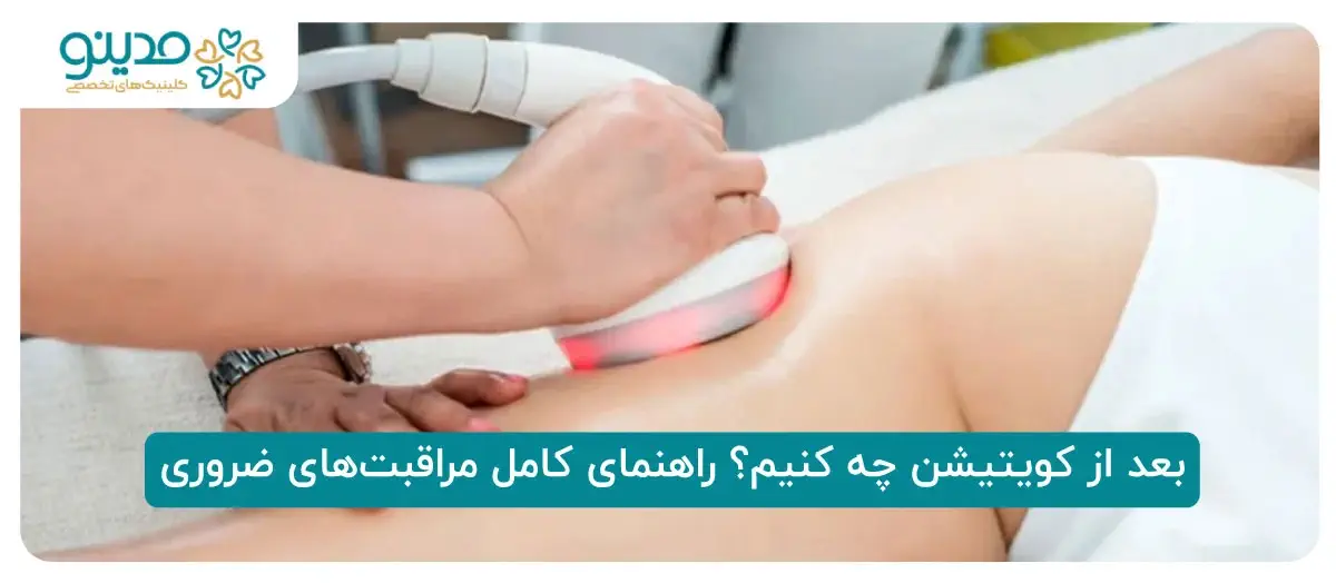 بعد از کویتیشن چه کنیم؟ راهنمای کامل مراقبت‌های ضروری