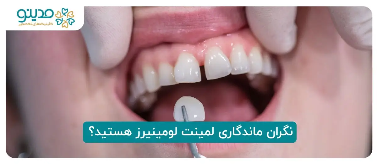 نگران ماندگاری لمینت لومینیرز هستید؟