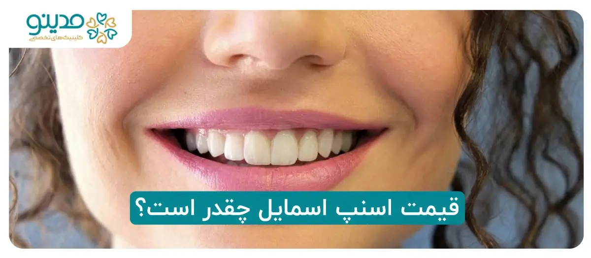 قیمت اسنپ اسمایل چقدر است؟